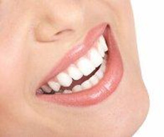 dental-veneers Picture of a smiling woman happy with her Costa Rica veneers.