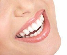 Picture of a smiling woman happy with her Costa Rica veneers.