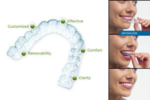 invisalign Picture of a female patient with her Costa Rica dentist.