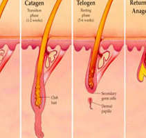 Illustration of a Fractional CO2 laser as it treats hair removal.
