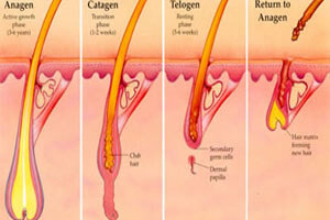 Illustration of a Fractional CO2 laser as it treats hair removal.