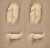 Before and After illustration of a male liposuction procedure as performed in Costa Rica.